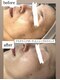 サロン ド モナ(salon de mona)の写真/【40代本気のエイジングケア】ハイパーナイフ×集中パックで気になるフェイスラインをキュッと引き締め