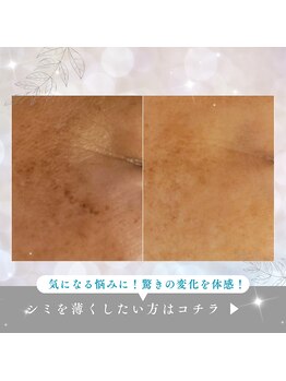 エメ(Aimer)の写真/紫外線ケアにはクリスティーナ・イラストリアス！シミ改善や美白ケアで輝くような透明感を演出★