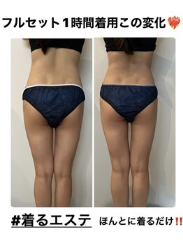 エムプリュ 心斎橋店(M.plus)/着るエステ