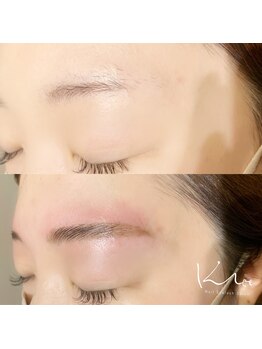 クレー(Klee)/アイブロウリフト