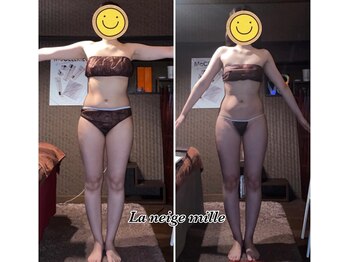 ラネージュミル(La neige mille)/インキュア痩身