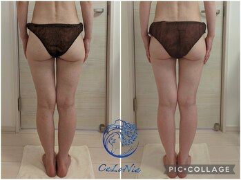 カロニア(CaLoNia)/下半身引き締め