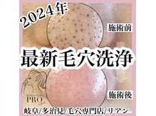 気になる詰まりはリアンへ！綺麗になります