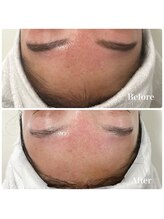 リアム(LiAm)/フェイスワックス