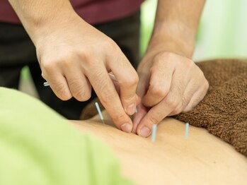 アスミルはり灸接骨院 春岡通店の写真/[吹上駅徒歩5分/土・祝日も営業]高技術×スピード施術★身体の不調を改善します◎定期的なメンテナンスに！