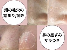 ココリール