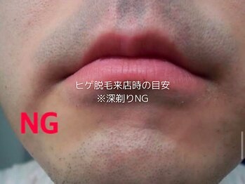 SEC(Shizuoka esthetic company)/【ヒゲ脱毛】来店時の目安