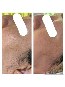 エクシア(ECXIA)/