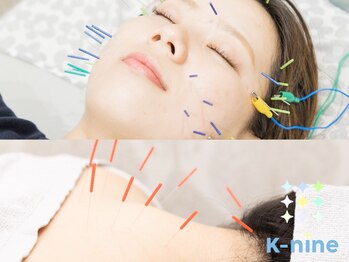 ケーナイン(K-nine)の写真/【首/肩こり/腰痛に！整体×鍼灸60分¥6980】お悩みに合わせて施術◎鍼打ち放題の電気美容鍼で徹底小顔ケア