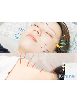 鍼灸施術を受けたい