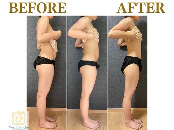 ヴェールブランシュ 町田(Vert Blanche)/#ブライダルエステ#痩身#くびれ