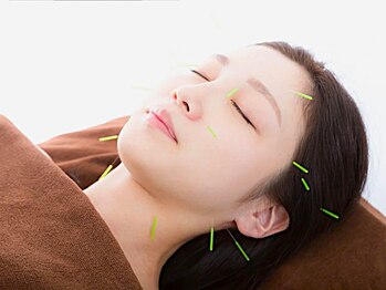 たいよう鍼灸整骨院の写真/【美容鍼が初めての方にオススメ!】リフトアップ効果◎リンパの流れを促進し、筋肉をほぐす小顔矯正◇