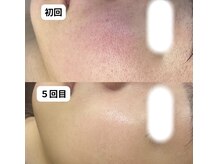 ベリスユイット(BELLIS HUIT)