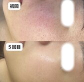 ベリスユイット(BELLIS HUIT)