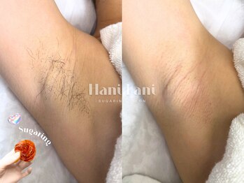 ハニ ラニ(Hani Lani)の写真/都度払いで安心★全メニュー都度払い制の為、気軽に始めて、気軽に続ける美肌ケアをご提案します♪