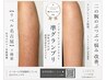 【体験】剥けるボディハーブピーリング！ハーブ２倍増量でパワー強【広範囲】