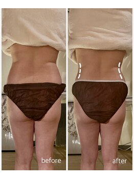 サロン ド サッコ(salon de sacco)/50代女性／腰まわりのもたつき