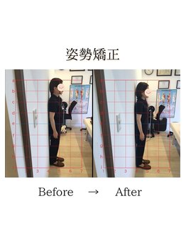 心斎橋長堀フェムテック整骨院/40姿勢矯正　骨格矯正と骨盤矯正