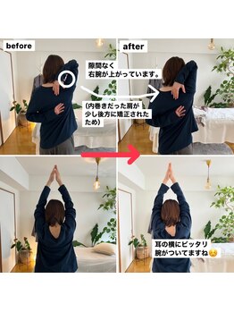 リリーボワ(LillyBois)/肩甲骨はがしビフォーアフター