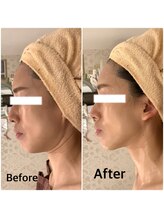 スペチアーレ 夙川/驚きの引き上がり