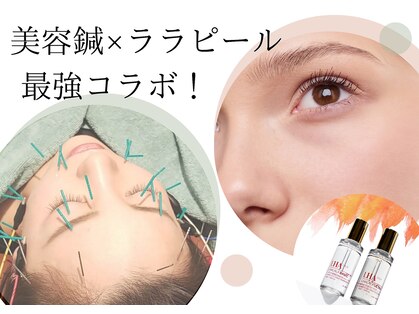 リノ(lino)の写真