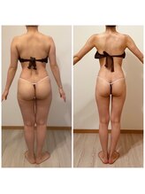 ヴィアス(VIAS)/セルゼロ全身18回目の結果