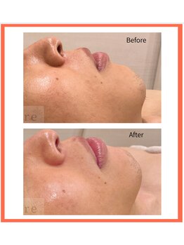 アールイー(re)/ララピール