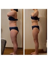 サロンドアクオン(salon de aqon)/体質は変化します!!