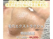 エムベル 越谷レイクタウン店(M belle)/いちご鼻卒業！！