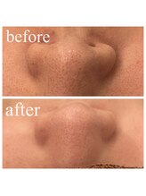 ディス イズ ミー エステティック(This is Me Aesthetic)/毛穴悩みおまかせ下さい！