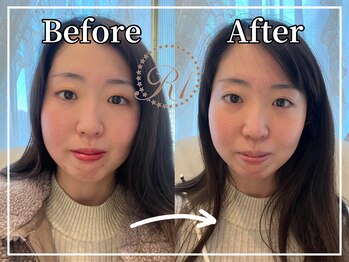 R-1ビューティーサロン 銀座/Before&After　
