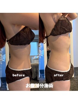 メトルミリ 新宿店(Metre milli)/ビフォーアフター