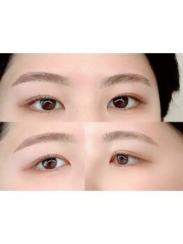 脱毛デビューにオススメのサロン