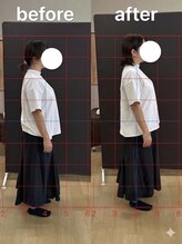 カワル整体 長嶺院/ストレートネック