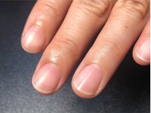 オーラリー ネイル アート メゾン(ORRERY nail art maison)/ハンド/ 深爪ケア