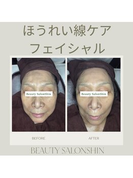 シン(Shin)/【ipsトリートメント】