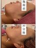 今だけ！平日13時～17時限定でお得に【小顔リフト×輪郭矯正】¥12000→¥10800