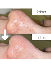 グラシア(gracia)/シミ・毛穴ケア専門店gracia