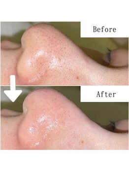 グラシア(gracia)/シミ・毛穴ケア専門店gracia