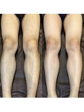 メンズ エステティック ヒーロー(men's esthetic HERO)/足ＷＡＸ