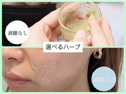 ソアン(Soin)の写真