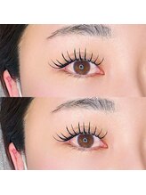 ノイ(neu)/バインドロック/ダブルフラット