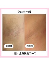 ルミエール(LUMIERU)/