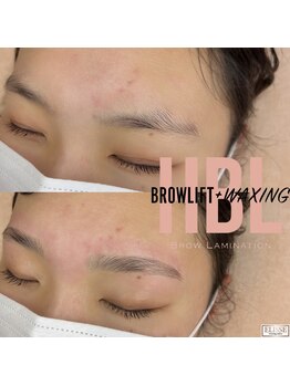 エリス(ELISSE)/ハリウッドブロウリフト