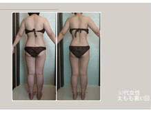 ビューティーサロン アール(R)/痩身マシーン太もも裏