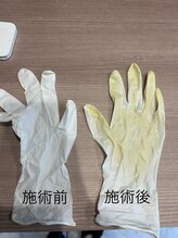 シェリーナ(cherieNa)/チノザメソッド　デトックス効果