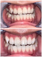 ライトビューティー 池袋店(LightBeauty)/症例写真