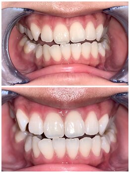 ライトビューティー 池袋店(LightBeauty)/症例写真