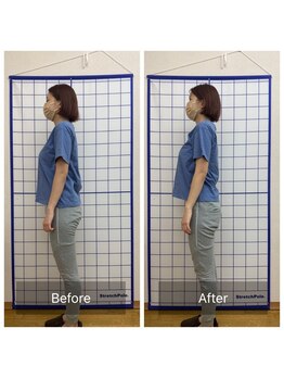 池川整骨院/姿勢矯正ビフォーアフター