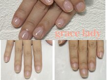 グレースレディ/可愛く矯正